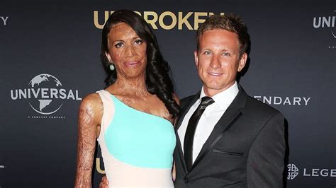 Australian Burns Survivor Turia Pitt Completes Triathlon Bbc News