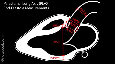 Parasternal Long Axis Echocardiogram View