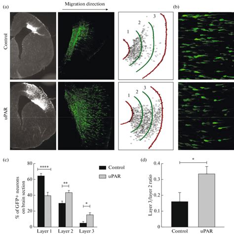 Upar Overexpression Stimulates The Migration Of Neurons In The Cerebral