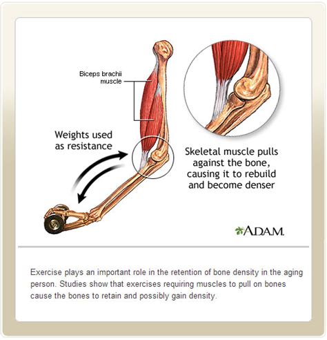 How Exercise Helps Bones - New Life Outlook | Osteoporosis