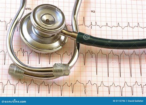 Ekg Stock Photo Image Of Doctor Ambulance Clinic Electrocardiogram