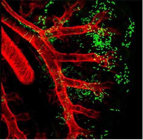 Lung Stem Cells Global Stem Cells Group