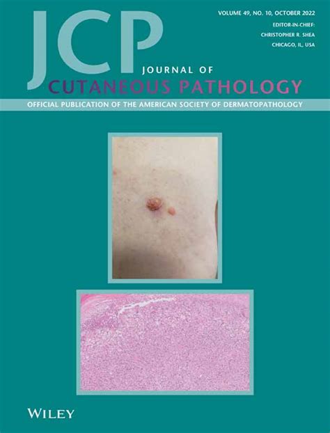 Journal Of Cutaneous Pathology Vol 49 No 10