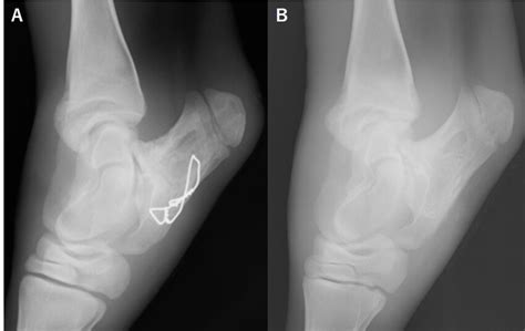 Lateromedial Radiographic View Of The Left Tarsus A Fifty Days After