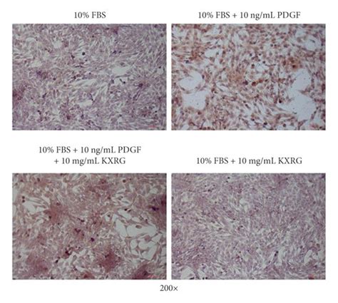 Kxrg Suppressed Proliferation Collagen Synthesis And Sma Expression