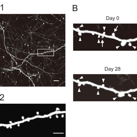 Morphological Changes Of Microglia After LPS Treatment A High