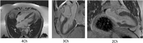 Heart Magnetic Resonance Imaging Heart Magnetic Resonance Imaging