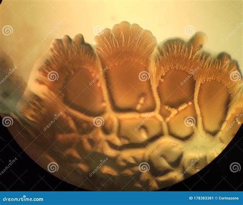 Bacterial Colonies Under The Microscope Beautiful Growth Stock Image Image Of Branched