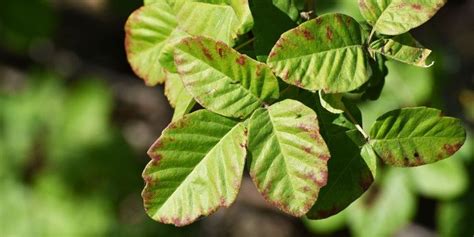 Heres What A Poison Oak Rash Looks And Feels Like According To