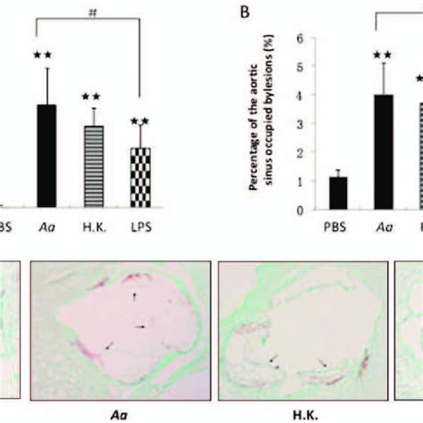 Atherosclerotic Plaque Formation In The Aortic Sinuses Of Apoe Shl Mice