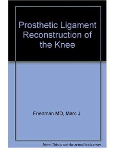 Prosthetic Ligament Reconstruction Of The Knee