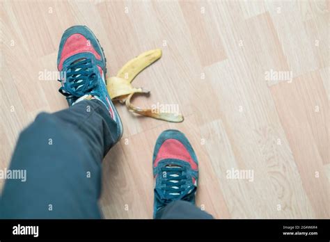 Leg Slip On Banana Peel And Have An Accident Stock Photo Alamy