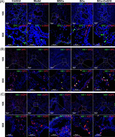 Immunofluorescence Of α Sma Spc Aqp5 And Hm In The Lung Section Of Download Scientific