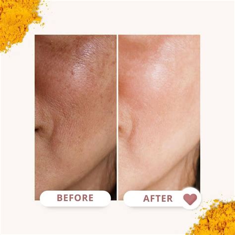 Noirwild Turmeric Serum Skin Care Wrinkles Natural Face Skin Care