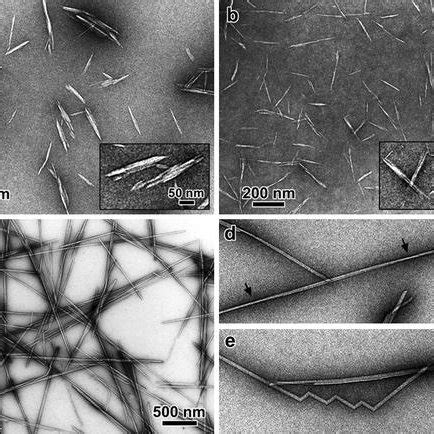 Tem Micrographs Of Negatively Stained Cellulose Nanowhiskers Obtained