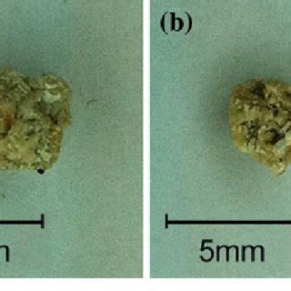 (PDF) Kidney Stone Erosion by Micro Scale Hydrodynamic Cavitation and Consequent Kidney Stone ...