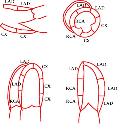 Cardiac Imaging In The Patient With Chest Pain Echocardiography Heart