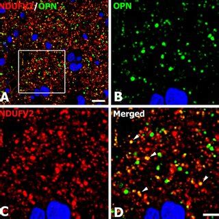 Relation Between Osteopontin Opn Expression And Nitropropionic Acid