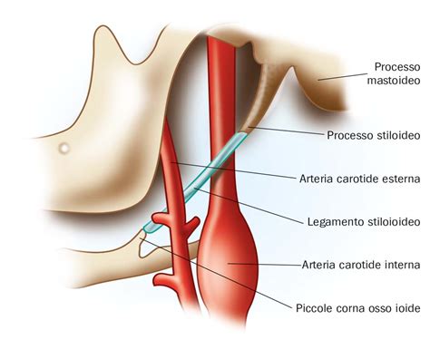 Sindrome Di Eagle Una Patologia Di Difficile Interpretazione