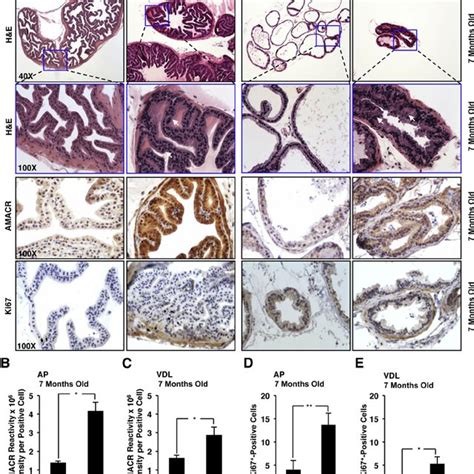 Sirt1 À À Mice Show Prostatic Intraepithelial Neoplasia Pin In