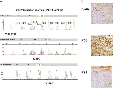 Examples Of Pcr Snapshot Fgfr3 Mutation Analysis And Altered