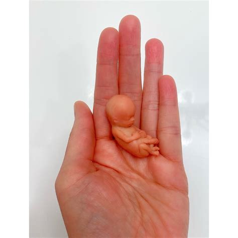 MADE TO ORDER 11 Week Gestation Fetus Stage Of Fetal Development