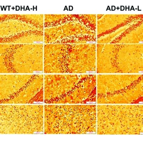 Effect Of DHA Treatment On Neurofibrillary Tangles In The Hippocampus