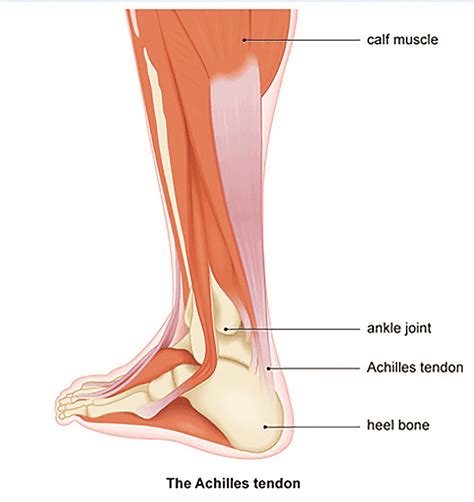 Achilles Tendonopathy Tendonitis And Ankle Pain Eltham Foot Clinic