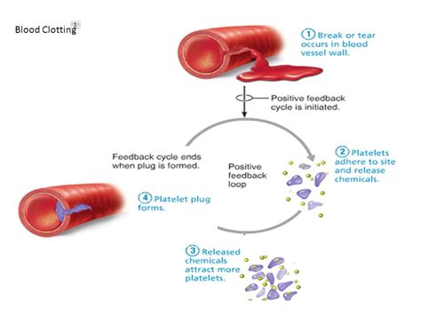 Images Of Blood Clot In Arm