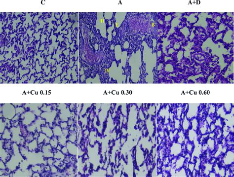 Photographs Of Lung Specimens Under A Light Microscope With A