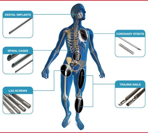 Tribology In Medical Implants About Tribology