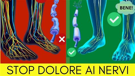 Neuropatia Periferica Gambe E Piedi YouTube