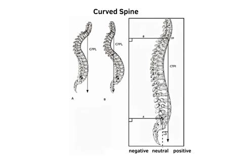 how to fix curved spine