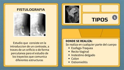 FISTULOGRAFIA