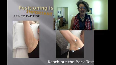 Breast Cancer Rehabilitation Never Miss Cording Or Aws Youtube