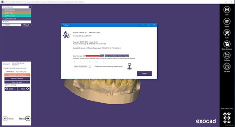Exocad Dentalcad Plovdiv Crack Dental Software