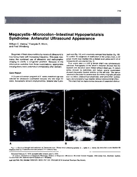 Pdf Megacystis Microcolon Intestinal Hypoperistalsis Syndrome A Case