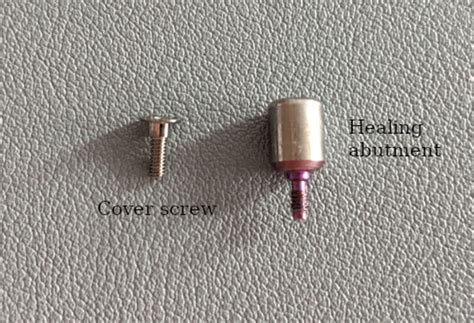 Healing Abutment Vs Cover Screw Implant Part Differences 1311