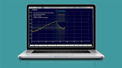 DMS Brasil Gravadores De Holter ECG Monitor Ambulatorial De