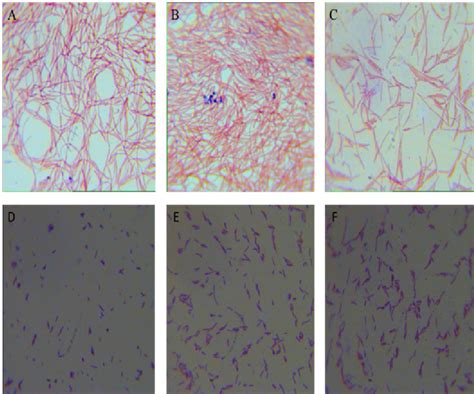 Gram stain images of selected isolates with binocular microscope ...