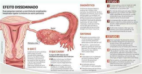 Jornal da Franca Cientistas apontam que ovário policístico pode