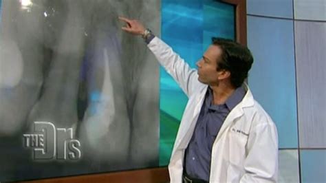 Dr Bill Dorfman Discovers A Dental Abscess On The Doctors Youtube