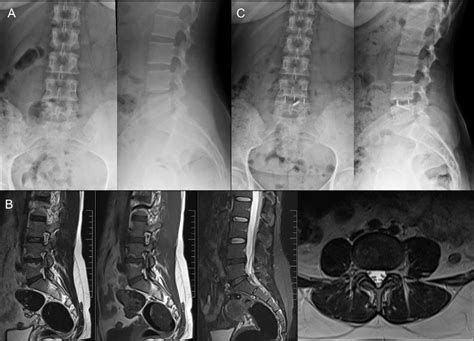 Case Presentation 30 Years Old Female Patient A Anterior Posterior