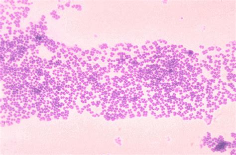 Gram Positive Cocci Microbiology Learning The Why Ology Of