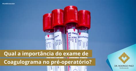 Qual a importância do exame de Coagulograma no pré operatório Dr