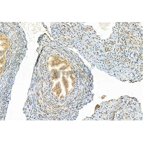 Phospho Erk Thr Tyr Thr Tyr Antibody Affinity