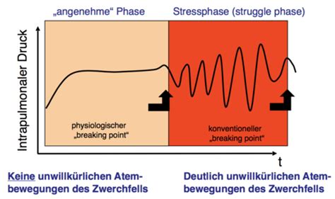 Apnoe II Karteikarten Quizlet