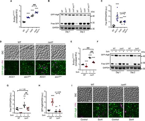 Acc Mediates Autophagy Regulation By Ampk Under Chronological Aging