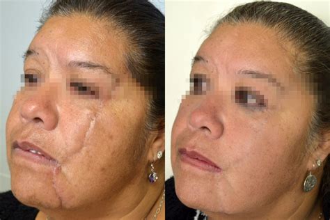 Trauma Facial La Serena Coquimbo