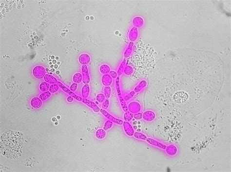 Chlamydospores